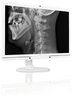 Philips LCD monitor with Clinical D-image C272P4QPKEW/00